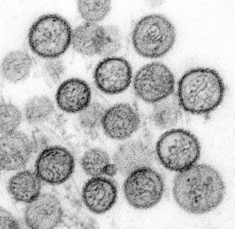 Hantavirus: qué es, cómo se contagia, síntomas y cómo prevenirlo
