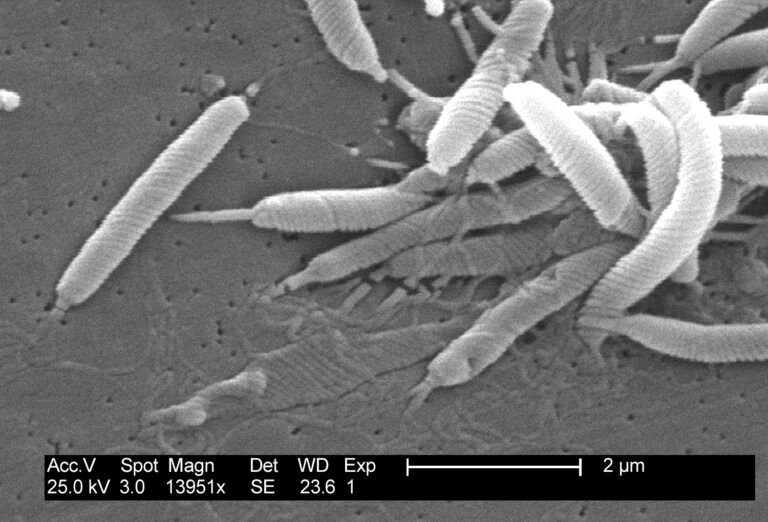 Helicobacter pylori: síntomas, contagio, tratamiento y cómo eliminar la bacteria