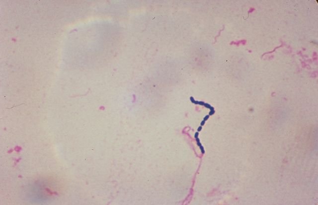 Infecciones por estreptococo: síntomas, tipos, contagio, tratamiento y prevención
